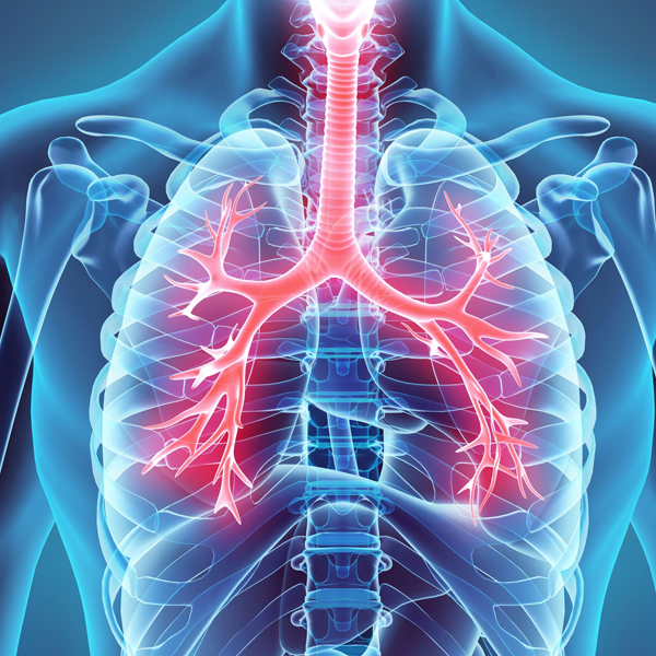 Critical Care Pulmonology MCQ