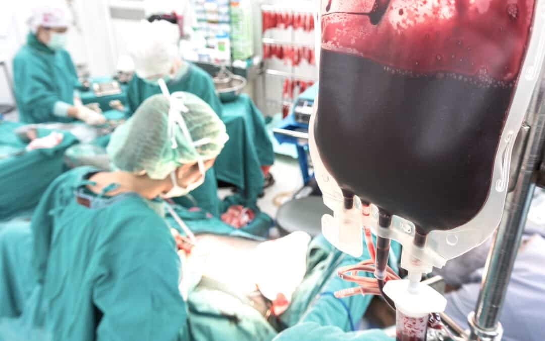 Critical Care Surgery MCQ